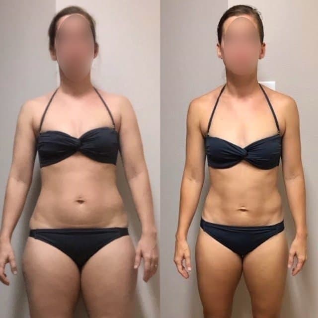 Pinnacle Weight Management Solutions